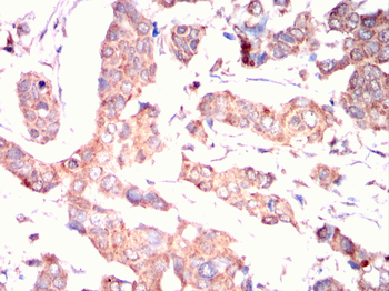 ULK3 Antibody