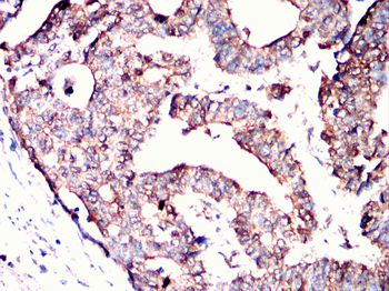 ULK3 Antibody