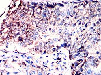 ULK3 Antibody