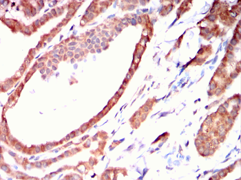 ULK3 Antibody