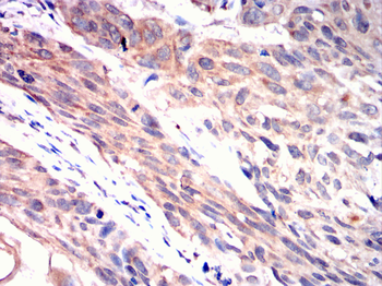 PFKP Antibody
