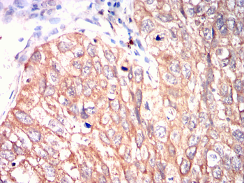PFKP Antibody