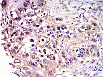 PFKP Antibody