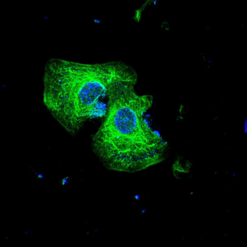 RAD23B Antibody