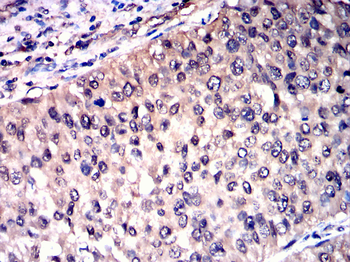 RAD23B Antibody