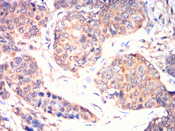 EI2BG Antibody