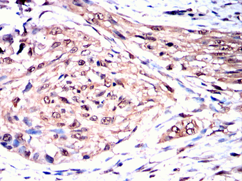 ATG4D Antibody