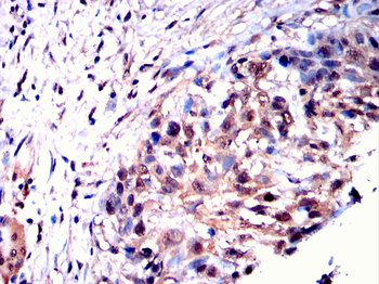 SUMO3 Antibody
