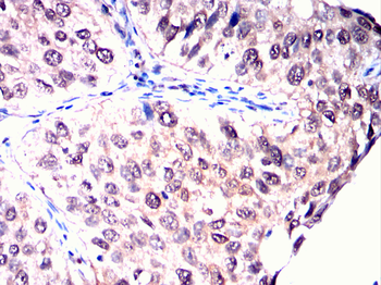SUMO3 Antibody