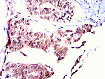 SUMO3 Antibody