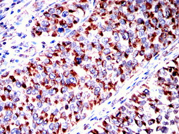 RPS6KB2 Antibody