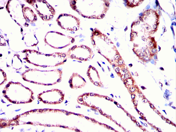 RPS6KB2 Antibody