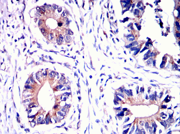 PACSIN2 Antibody