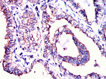 PACSIN2 Antibody