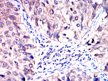 PACSIN2 Antibody
