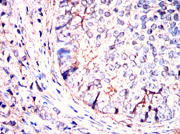 PACSIN2 Antibody