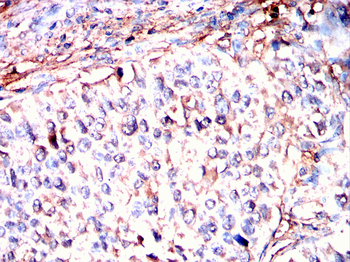 TGM2 Antibody