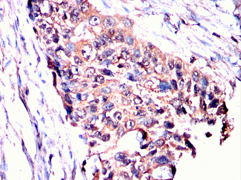 TGM2 Antibody