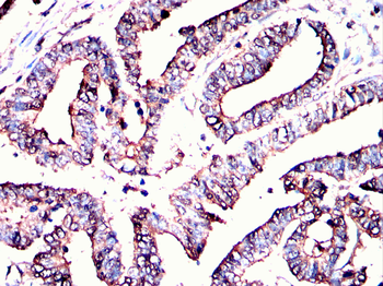 GDF15 Antibody