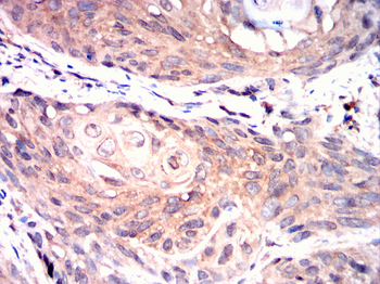 GDF15 Antibody