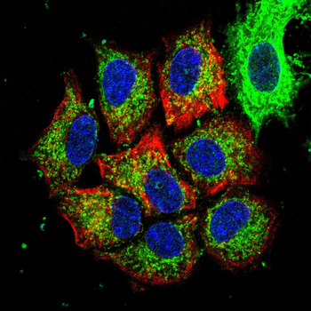 SERPINB3 Antibody