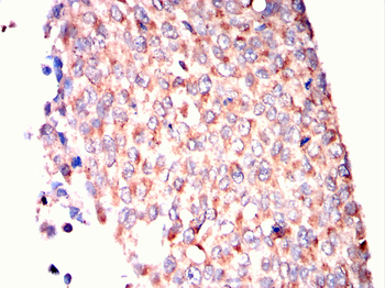 SERPINB3 Antibody