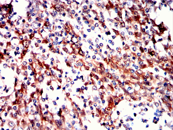 SERPINB3 Antibody