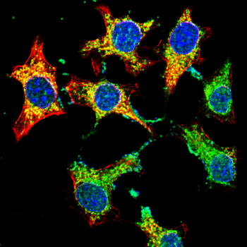 SPARC Antibody