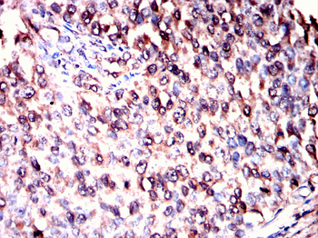 SPARC Antibody