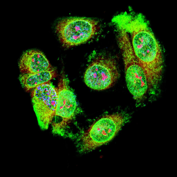 IKBKG Antibody