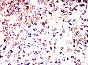 IKBKG Antibody
