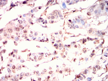 PRDM10 Antibody