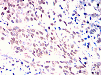 PRDM10 Antibody