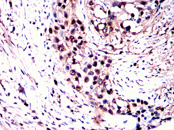 PRDM10 Antibody