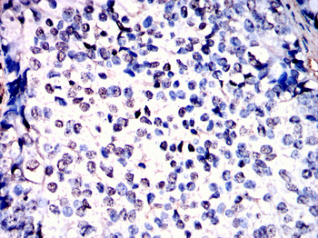 PRDM10 Antibody