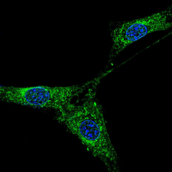 ACVR1B Antibody