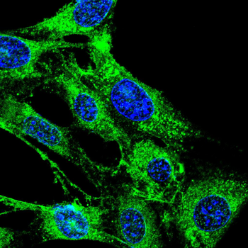 ARSA Antibody
