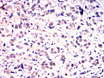 MAP4K3 Antibody