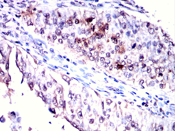 CLIC4 Antibody