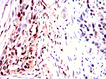 CLIC4 Antibody