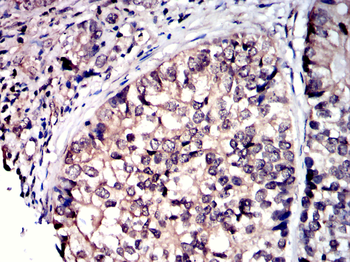 CLIC4 Antibody