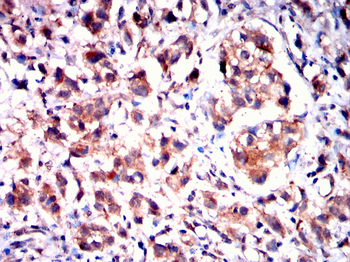 RAB11A Antibody