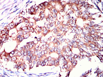 RAB11A Antibody