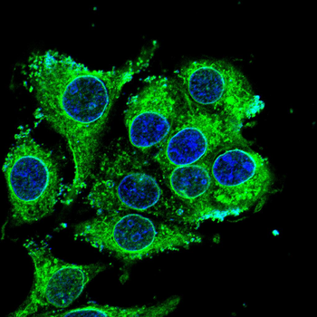 TOR1A Antibody
