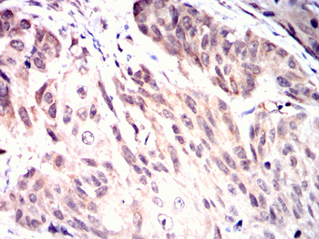 LGALS3 Antibody