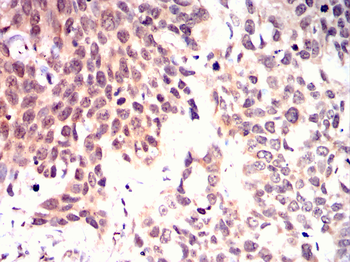 LGALS3 Antibody