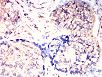 CNOT4 Antibody