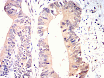 PRKAB1 Antibody