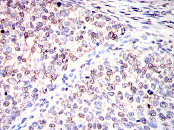 ADAMTS4 Antibody