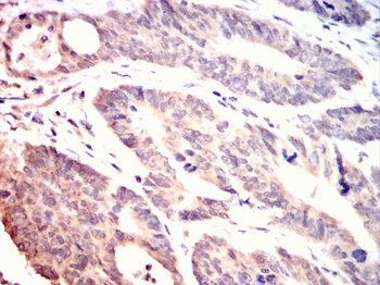 ADAMTS4 Antibody
